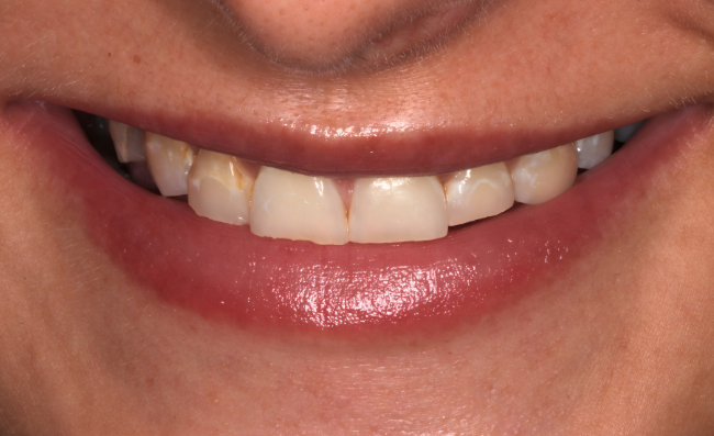 Before - Dr Saf Johar