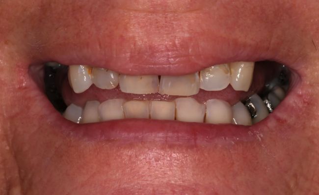 Before - Dr Saf Johar