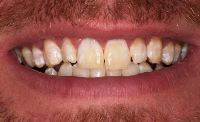 Before - Dr Saf Johar