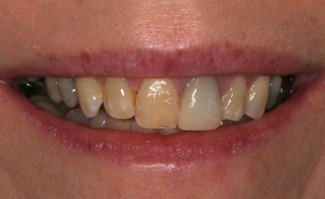 Before - Dr Saf Johar