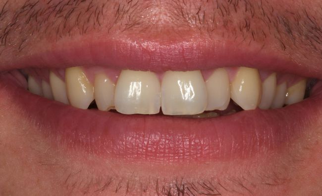 Before - Dr Saf Johar