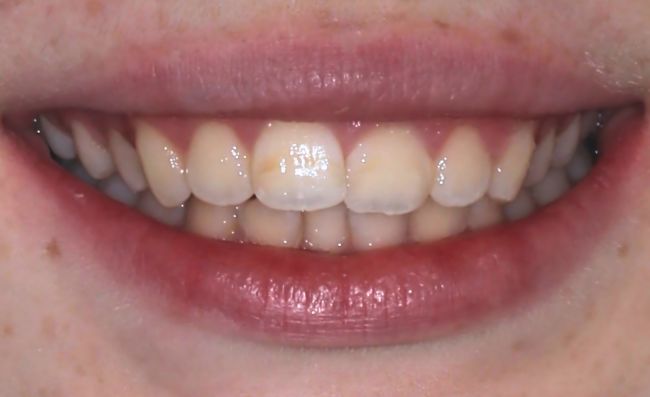 Before - Dr Saf Johar