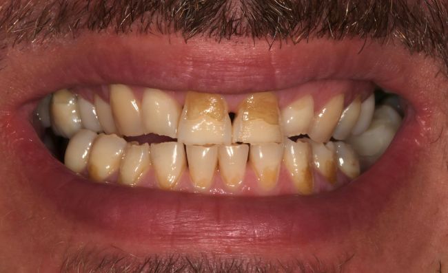 Before - Dr Saf Johar