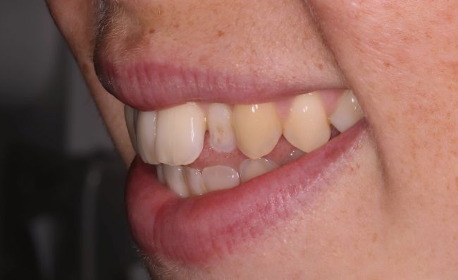 Before - Dr Saf Johar